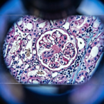 Eiweißbedarf bei Nierenfunktionsstörungen: Prof. Dr. Markus Masin zur Balance zwischen Wundheilung und Renoprotektion