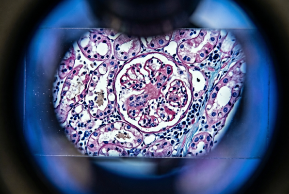 Eiweißbedarf bei Nierenfunktionsstörungen: Prof. Dr. Markus Masin zur Balance zwischen Wundheilung und Renoprotektion